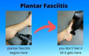 Infographic How To Fix Plantar Fasciitis Picture Of Leg Calf Picture Of Heel Arch Fasciitis