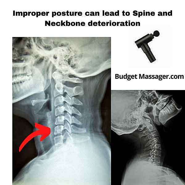 Improper posture can lead to Spine and Neckbone deterioration